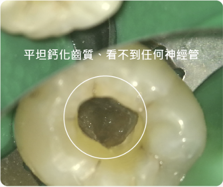 顯微鏡下找不到入口