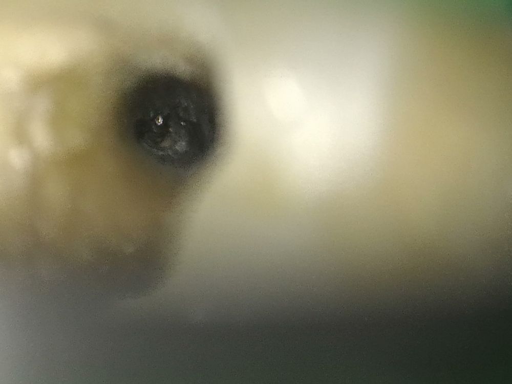 顯微鏡最高倍率下看到的分離器械